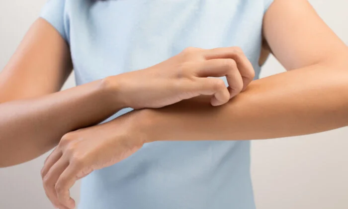 Itchy Skin No Rash: What Does It Mean?