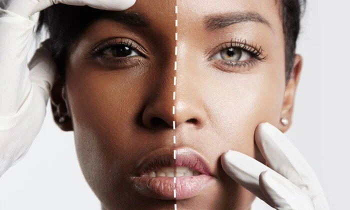Stay Natural with Your Skin Bleaching Cream