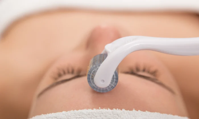 How to do Microneedling at home during lockdown